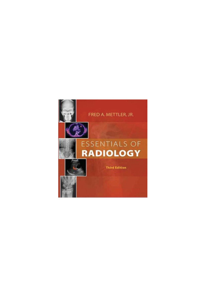 Essentials of Radiology