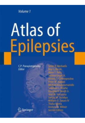Atlas of Epilepsies.